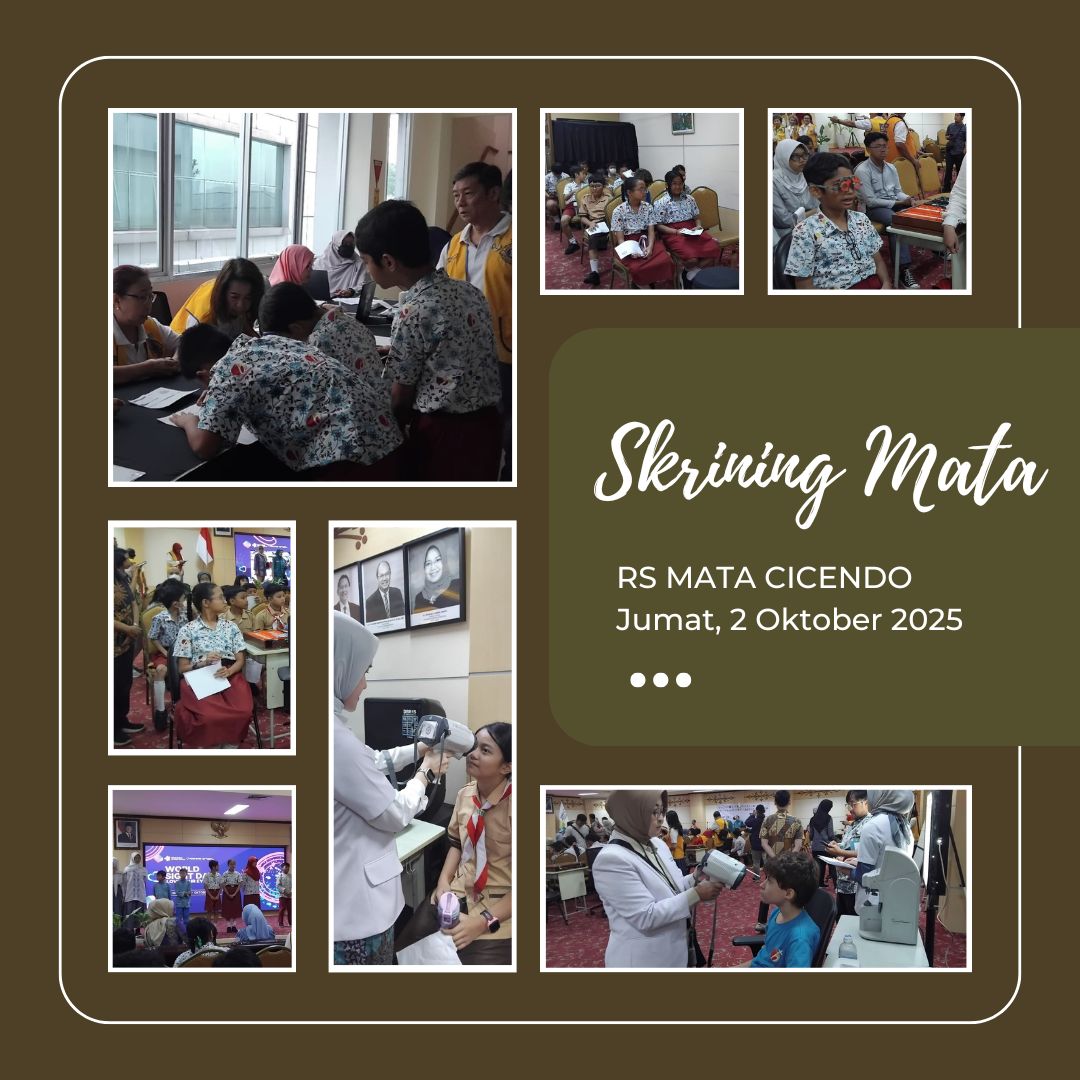 Pemeriksaan Mata Gratis di RS Mata Cicendo